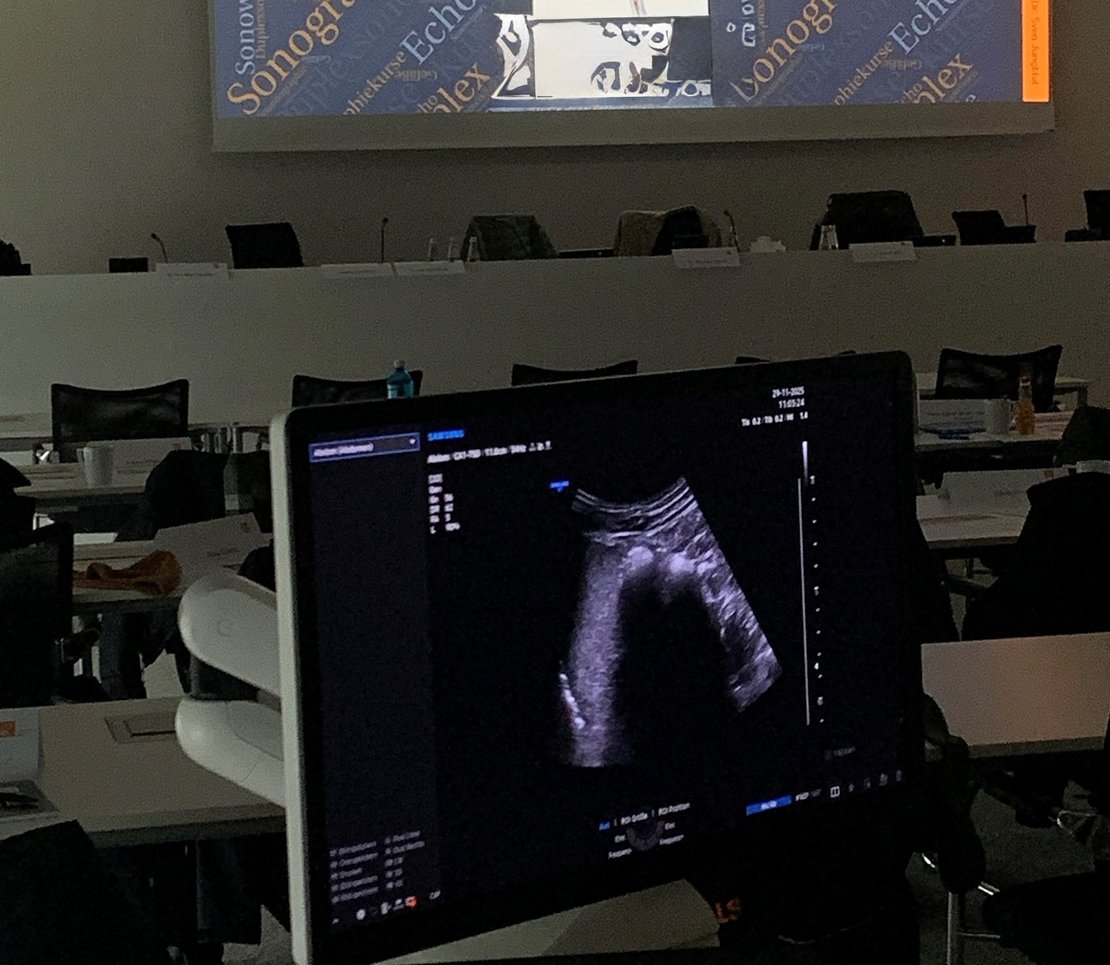 Im Hintergrund eines Sonogerätes erkennt man eine Präsentationsfolie, die Sonographie-Kurs liest.