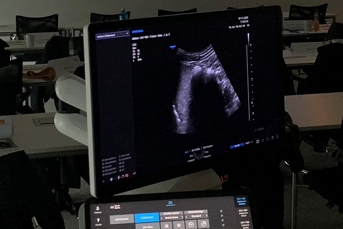 Im Hintergrund eines Sonogerätes erkennt man eine Präsentationsfolie, die Sonographie-Kurs liest.